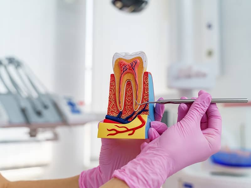 Kanal Tedavisi (Endodonti)