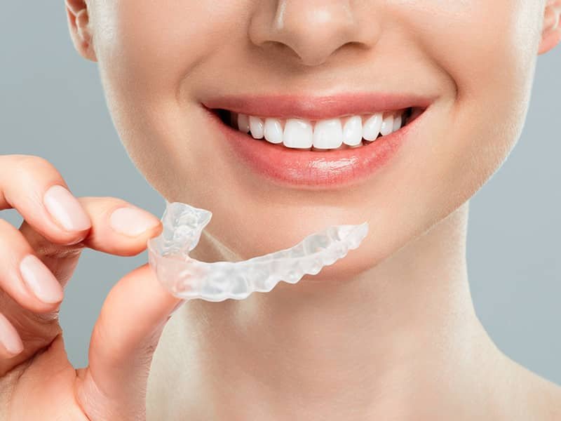 Şeffaf Plak Tedavisi